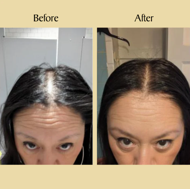 Arona™ Veganic Natural Hair Growth Oil