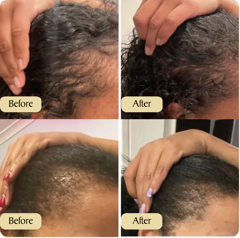Arona™ Veganic Natural Hair Growth Oil