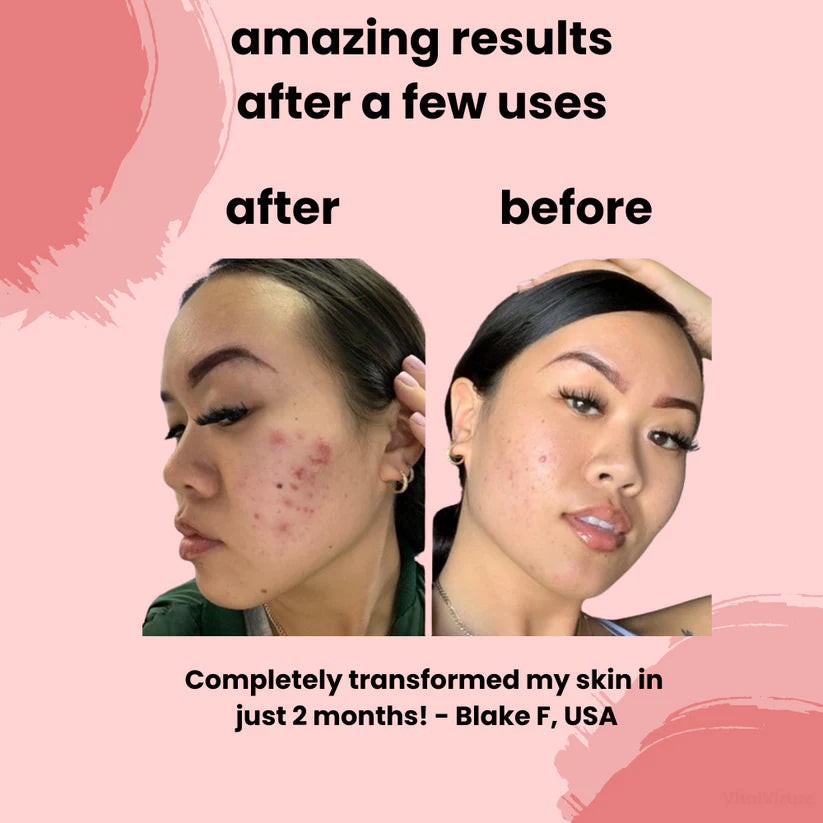 Arona™ Turmeric & Kojic Acid Cleansing Pads
