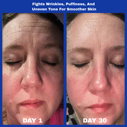 Arona™ 345 Skin Reset Relief Cream