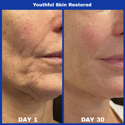 Arona™ 345 Skin Reset Relief Cream