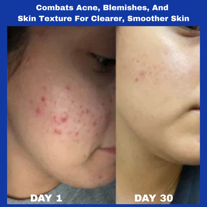 Arona™ 345 Skin Reset Relief Cream