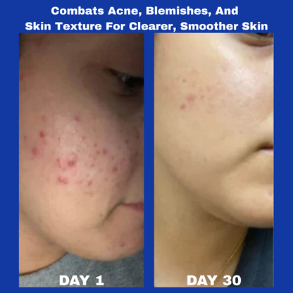 Arona™ A313 Skin Revival Cream