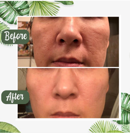 Arona™ Green Tea Glow Stick