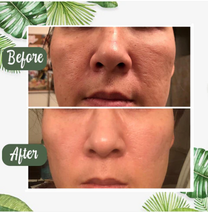 Arona™ Green Tea Glow Stick