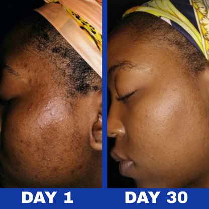 Arona™ A313 Skin Revival Cream