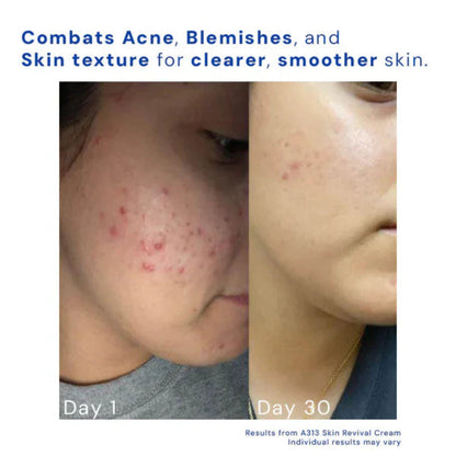 Arona A313 Skin Revival Cream